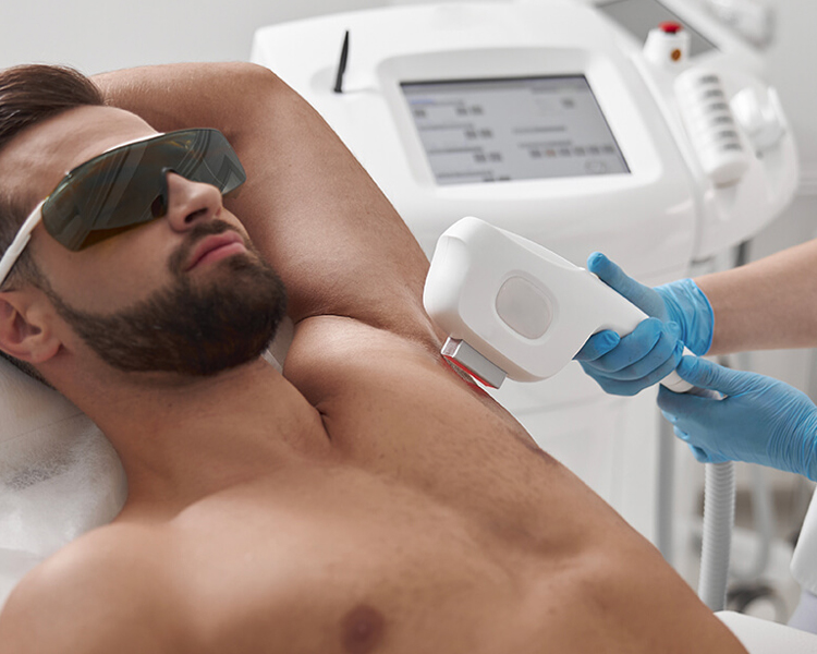 Erkek Epilasyon İncelikleri